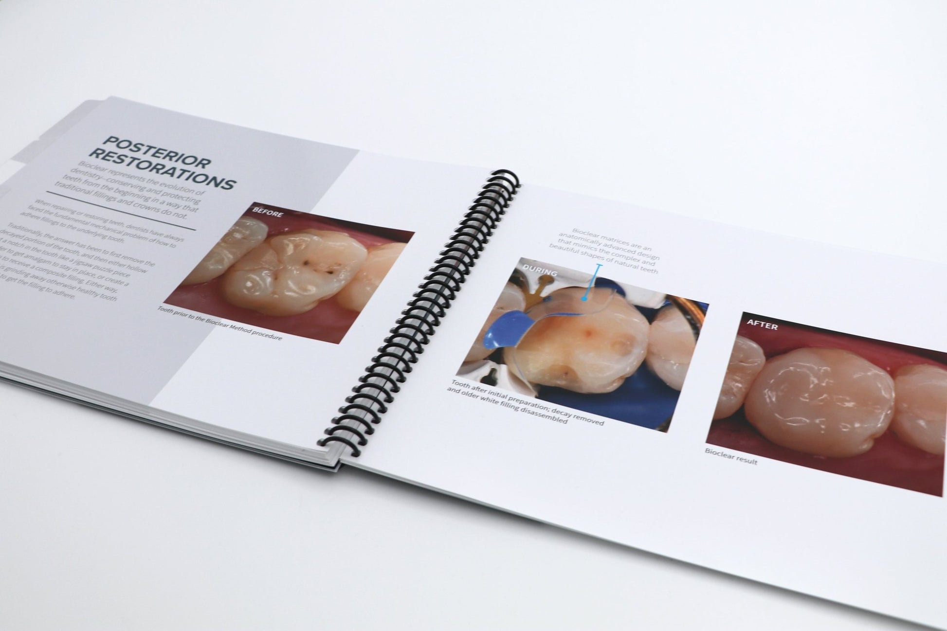 Chairside Patient Book - bioclearmatrix.co.uk 700331 Bioclear