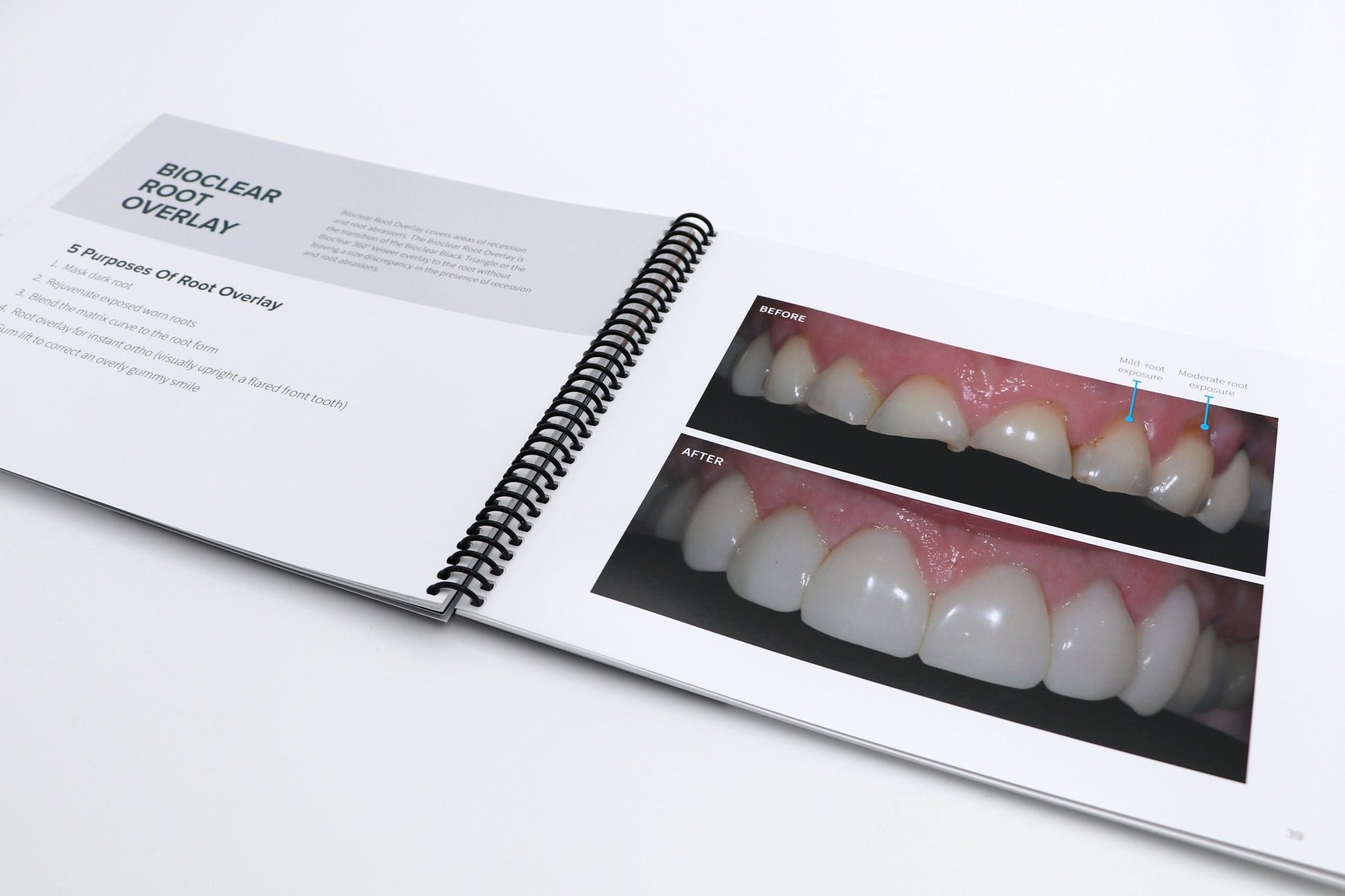 Chairside Patient Book - bioclearmatrix.co.uk 700331 Bioclear