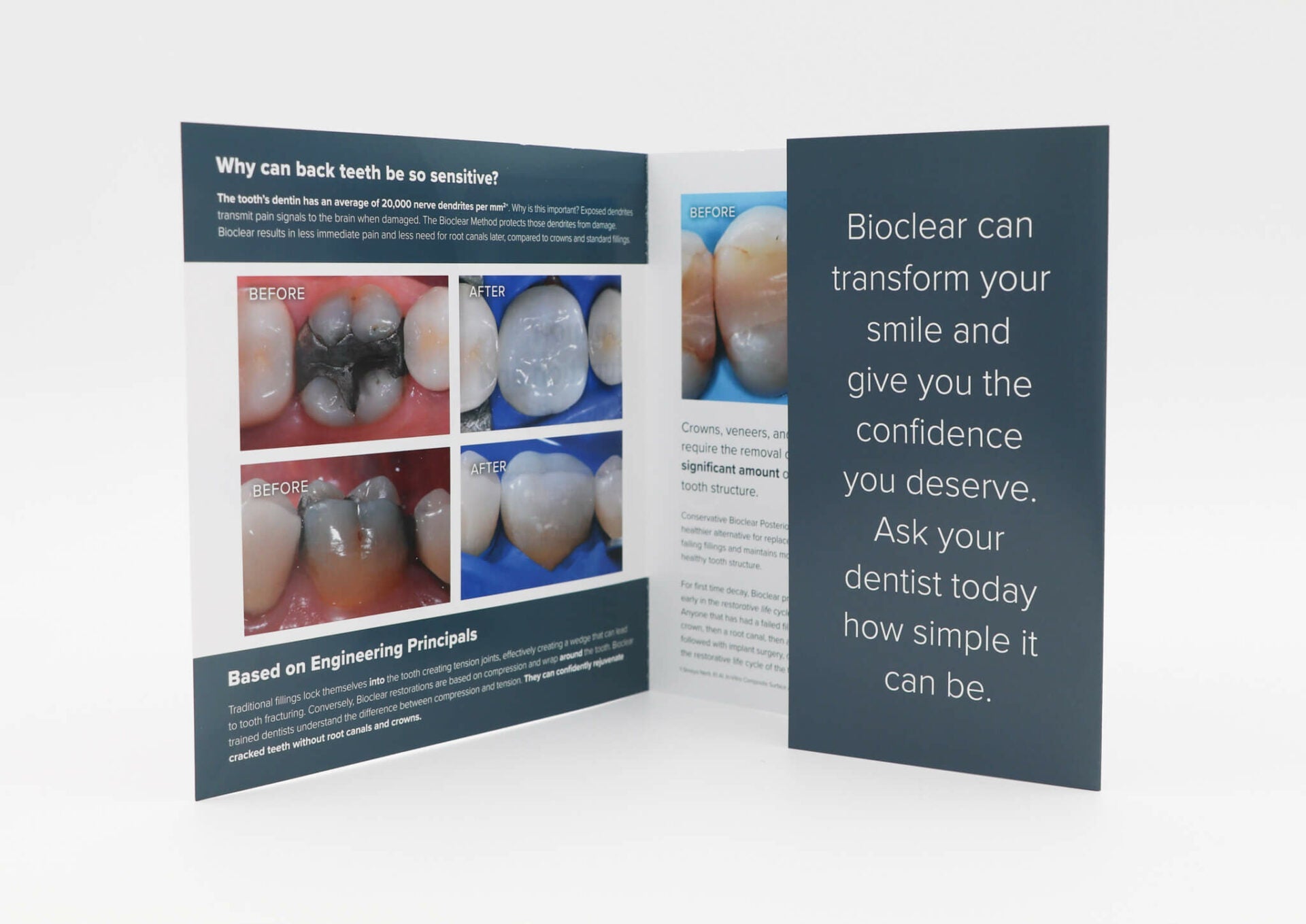 Patient Brochure Variety Pack - bioclearmatrix.co.uk 800071 Bioclear