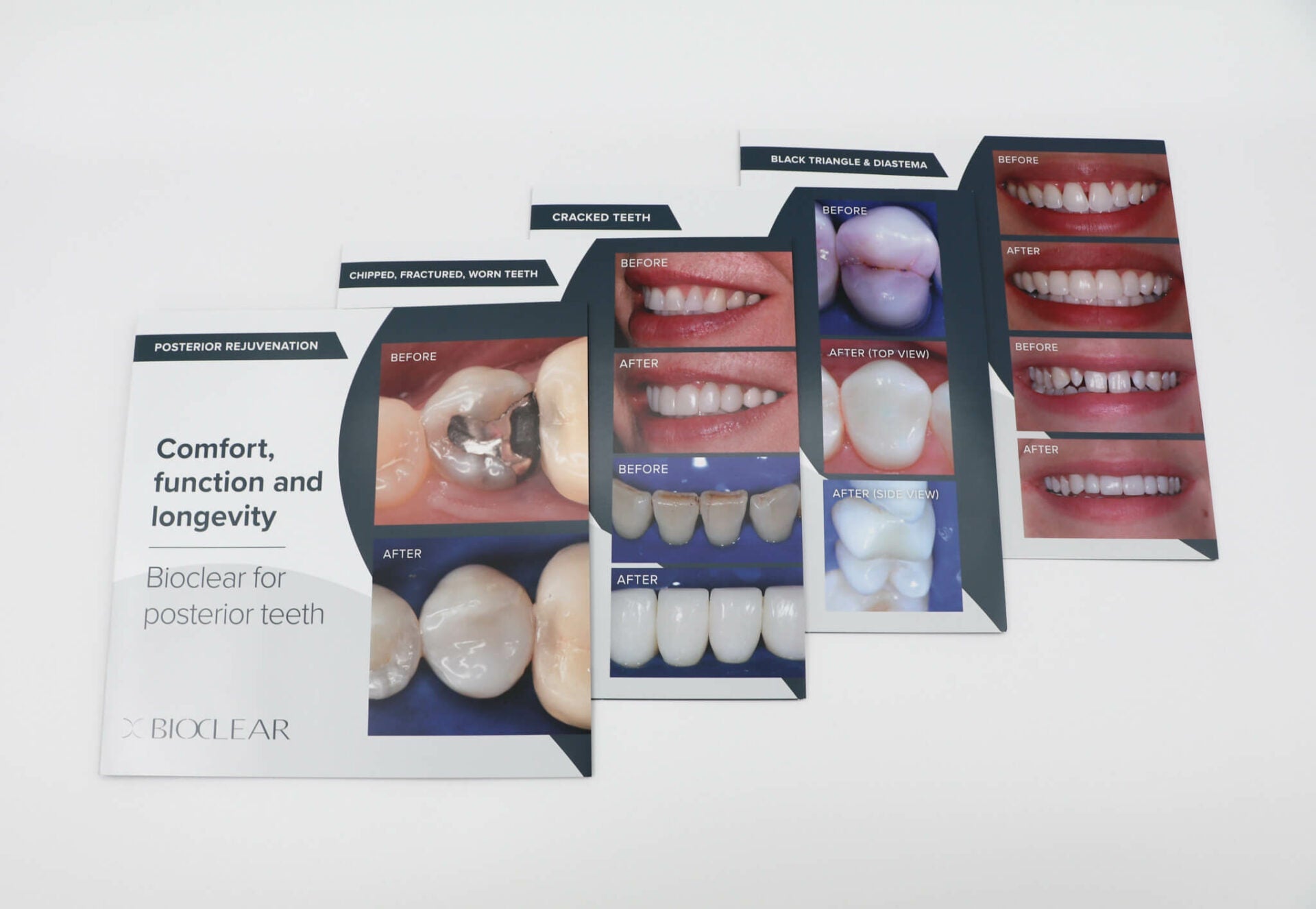 Patient Brochure Variety Pack - bioclearmatrix.co.uk 800071 Bioclear