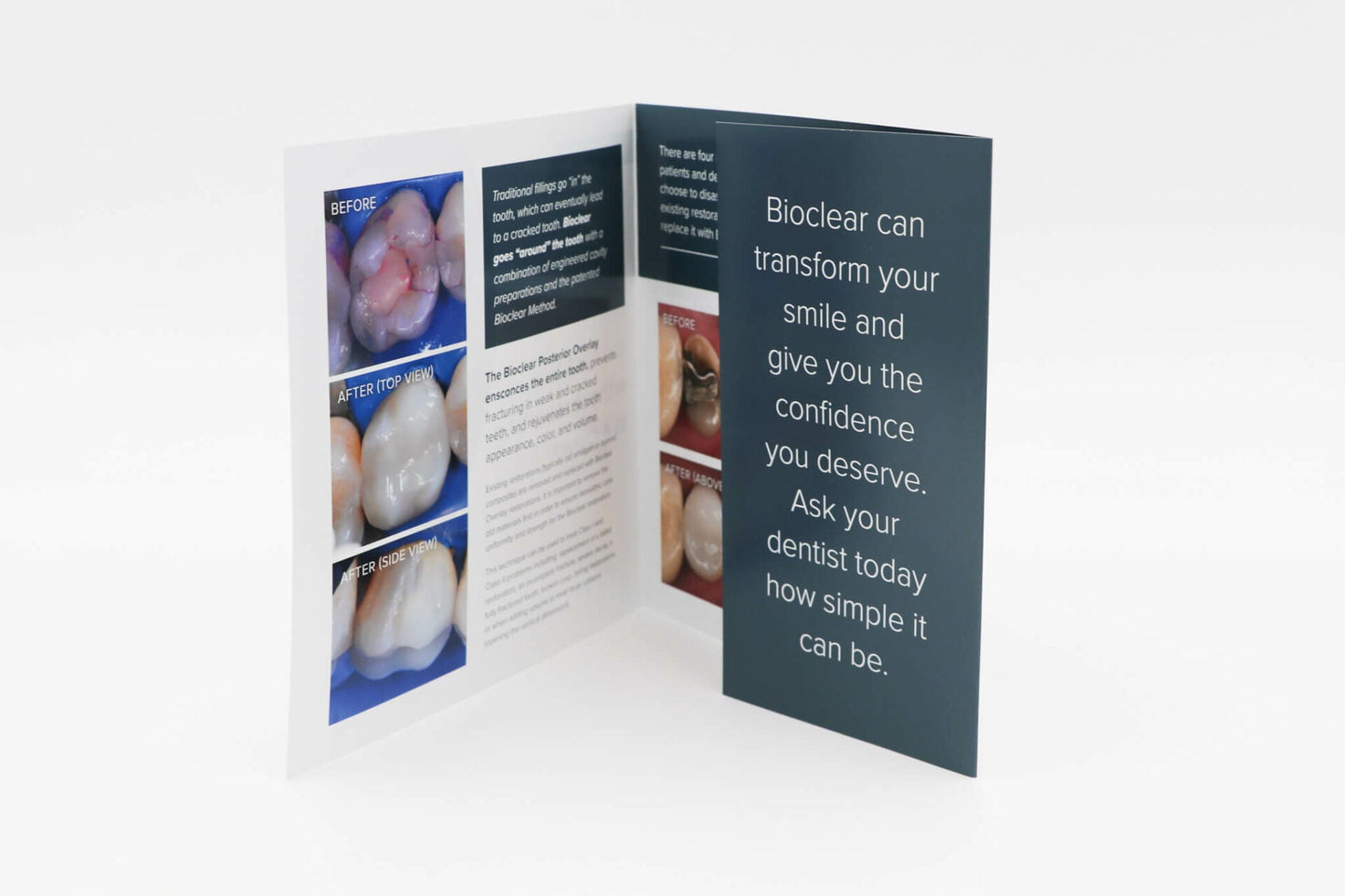 Patient Brochure Variety Pack - bioclearmatrix.co.uk 800071 Bioclear